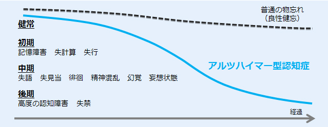 アルツハイマー型認知症の経過